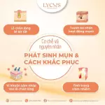Tinh Chất Peel LYCOS 10% AHA – 10% Lactic acid – 2% BHA Tẩy Tế Bào Chết, Thông Thoáng Lỗ Chân Lông & Hỗ Trợ Làm Đều Màu Da 20ml