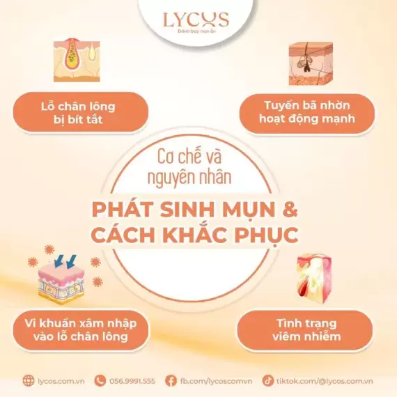 Cơ chế là nguyên nhân phát sinh mụn và cách khắc phục